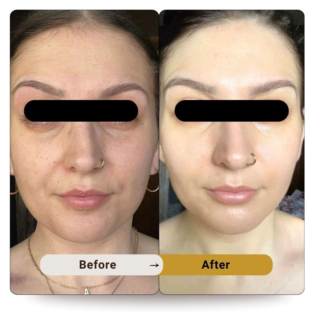 Red light therapy: What the science says - Stanford Medicine